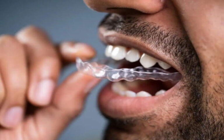 How To Stop Grinding Teeth In Sleep Naturally