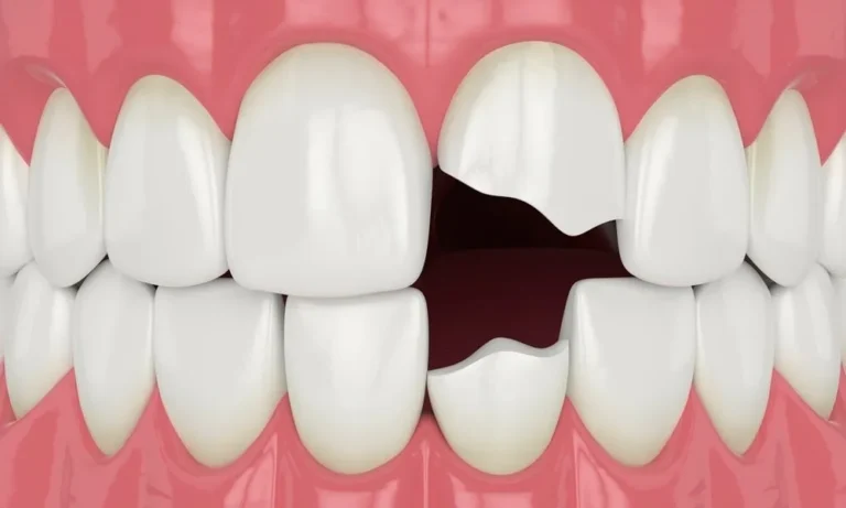 My Tooth Chipped Off for No Reason