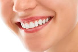 Rediscover Confidence with a Complete Smile Restoration