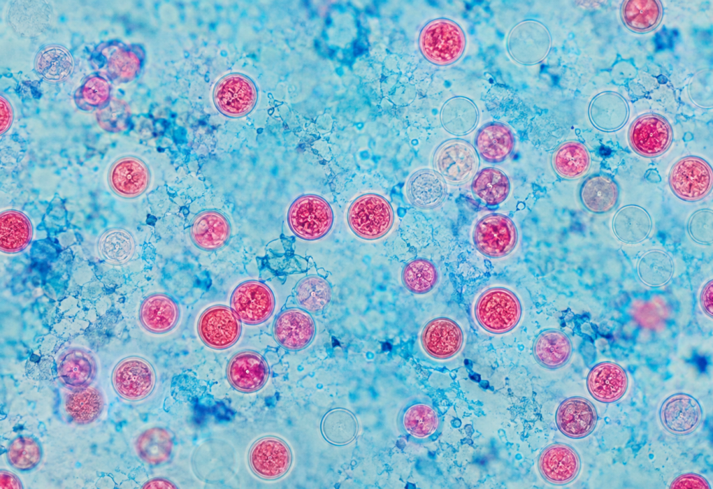 Cyclospora Outbreak UK