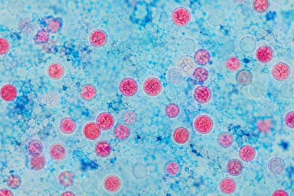 Cyclospora Outbreak UK