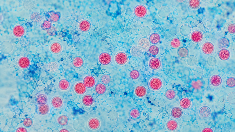 Cyclospora Outbreak UK