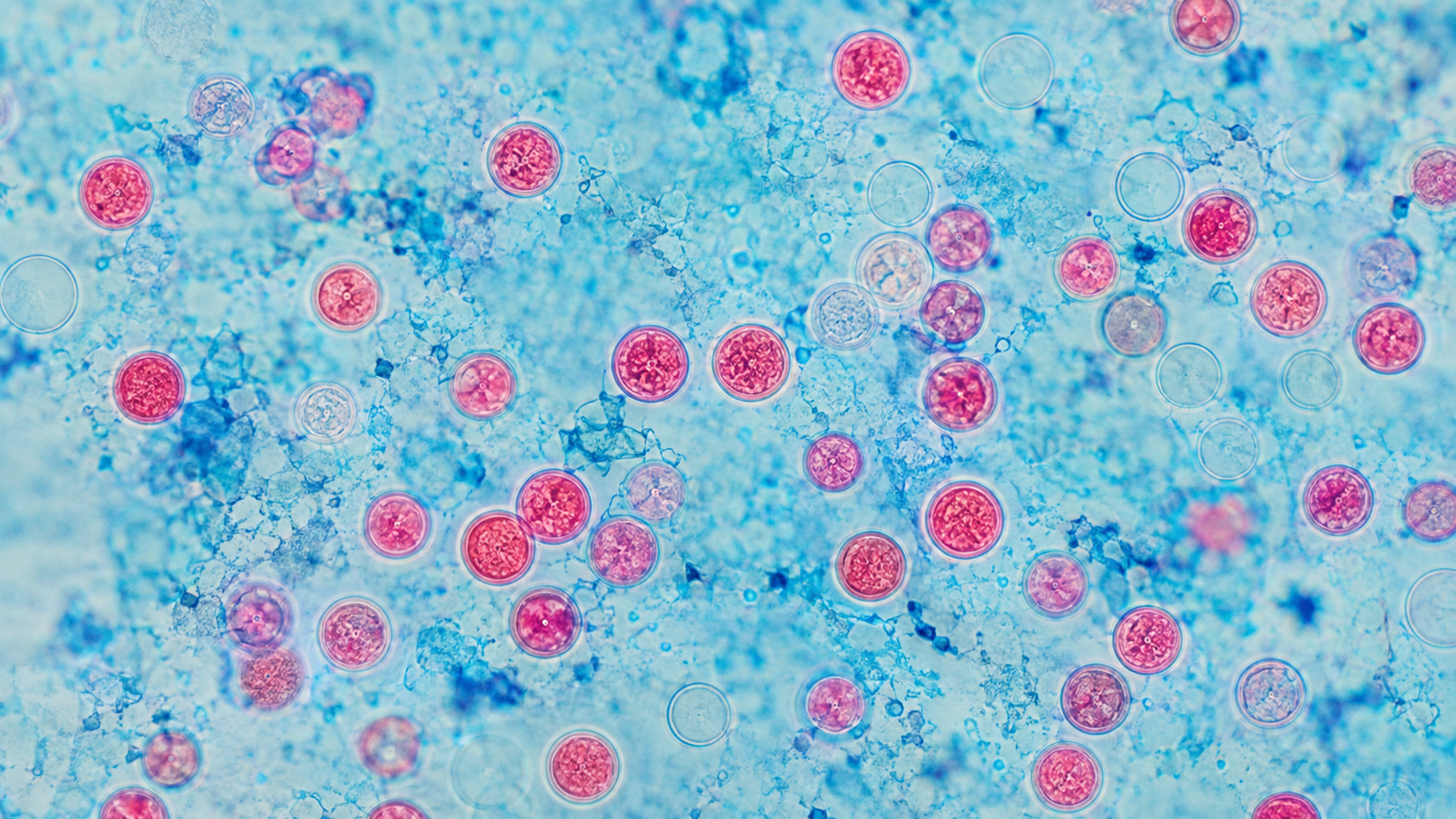 Cyclospora Outbreak UK